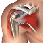 Biceps Tenodesis