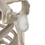 Cartilage Restoration of the Glenohumeral Joint