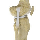 Lateral Collateral Ligament (LCL) Reconstruction