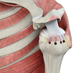 Rotator Cuff Repair