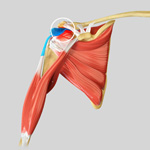 Sub-acromial Decompression