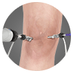 Arthroscopic Surgery